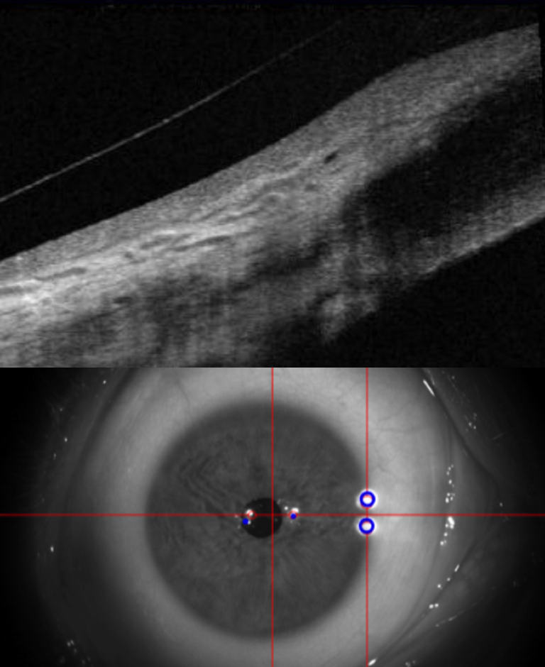 A close up eye with crosshairs
