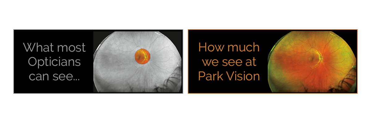 Comparison of optician's view of the eye