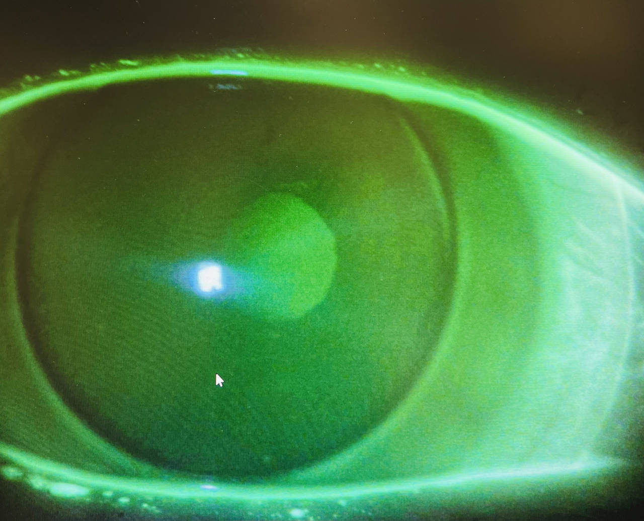 Scleral lens test