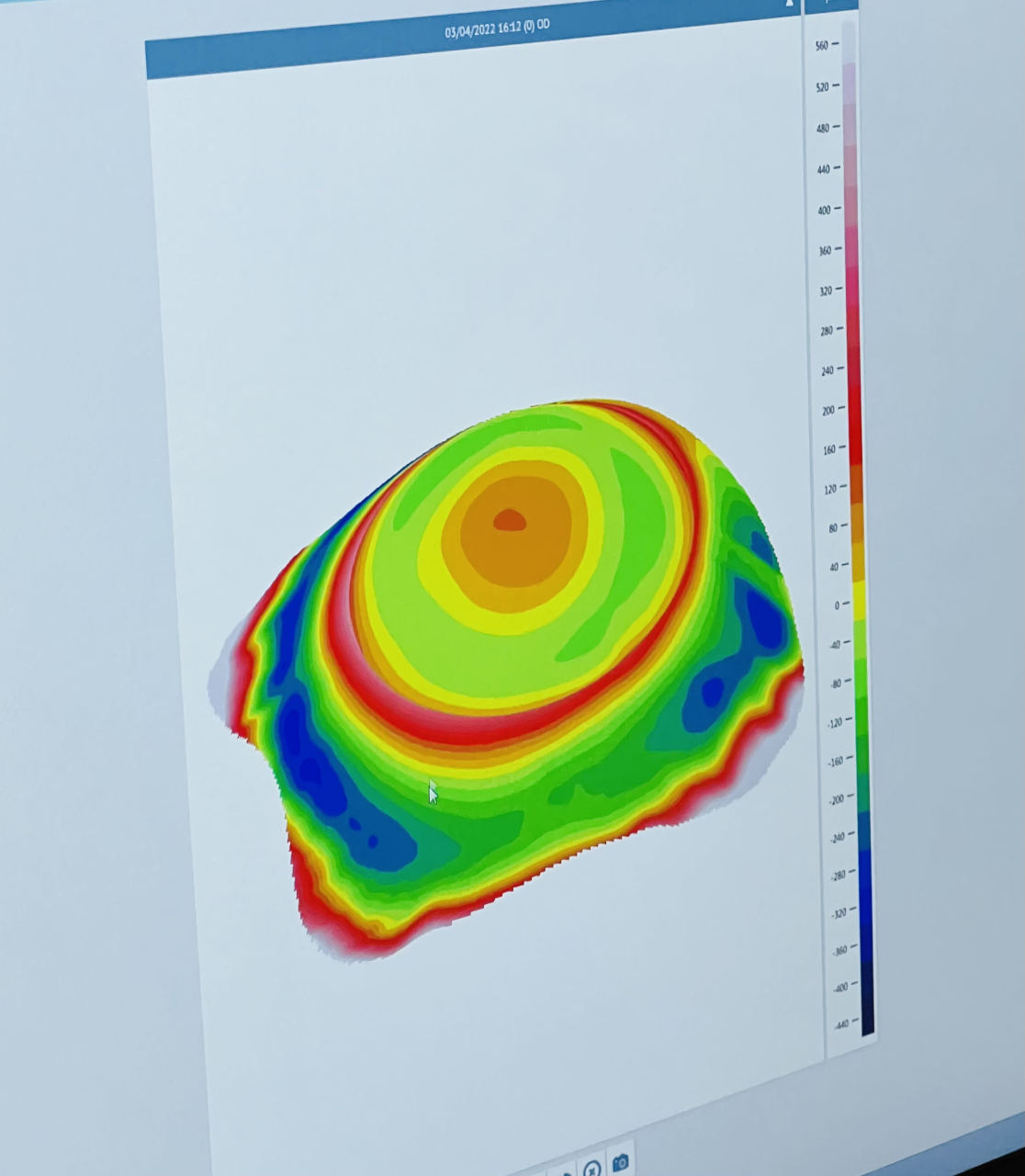 Advanced tests for scleral lenses at Park Vision