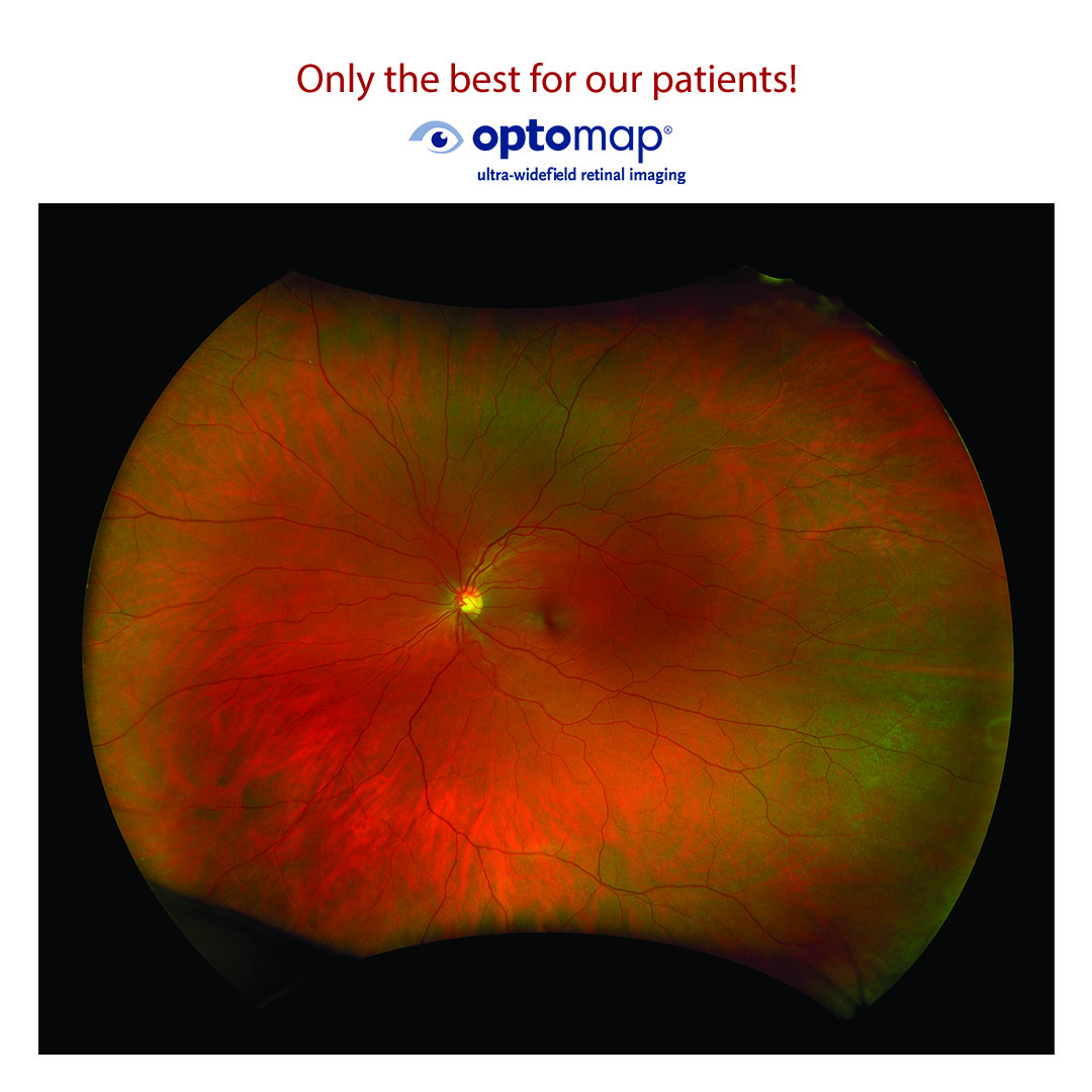 Only the best for our patients! Optomap - ultra-widefield retinal imaging